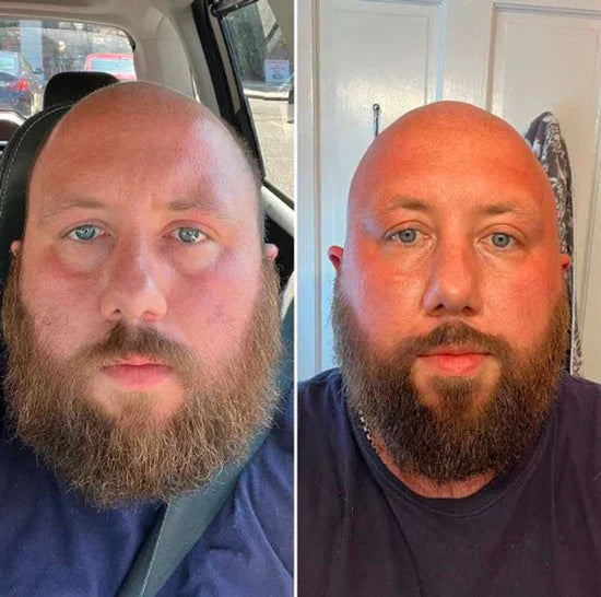 EYEPHALT - Contorno de Ojos Antiarrugas Iluminador Rejuvenecedor