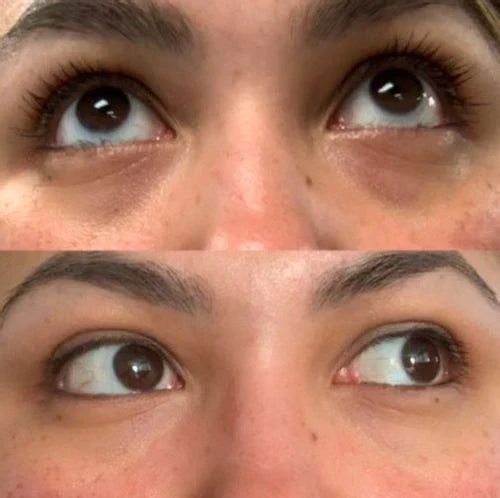 EYEPHALT - Contorno de Ojos Antiarrugas Iluminador Rejuvenecedor