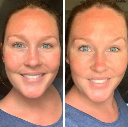 EYEPHALT - Contorno de Ojos Antiarrugas Iluminador Rejuvenecedor