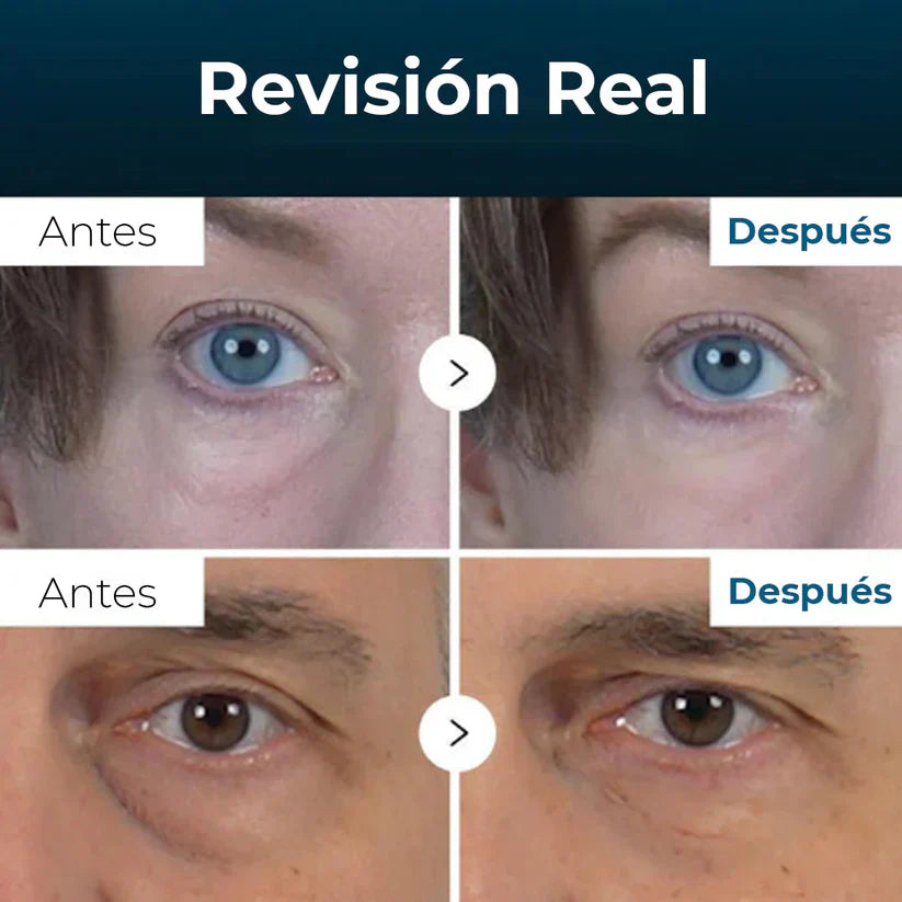 EYEPHALT - Contorno de Ojos Antiarrugas Iluminador Rejuvenecedor