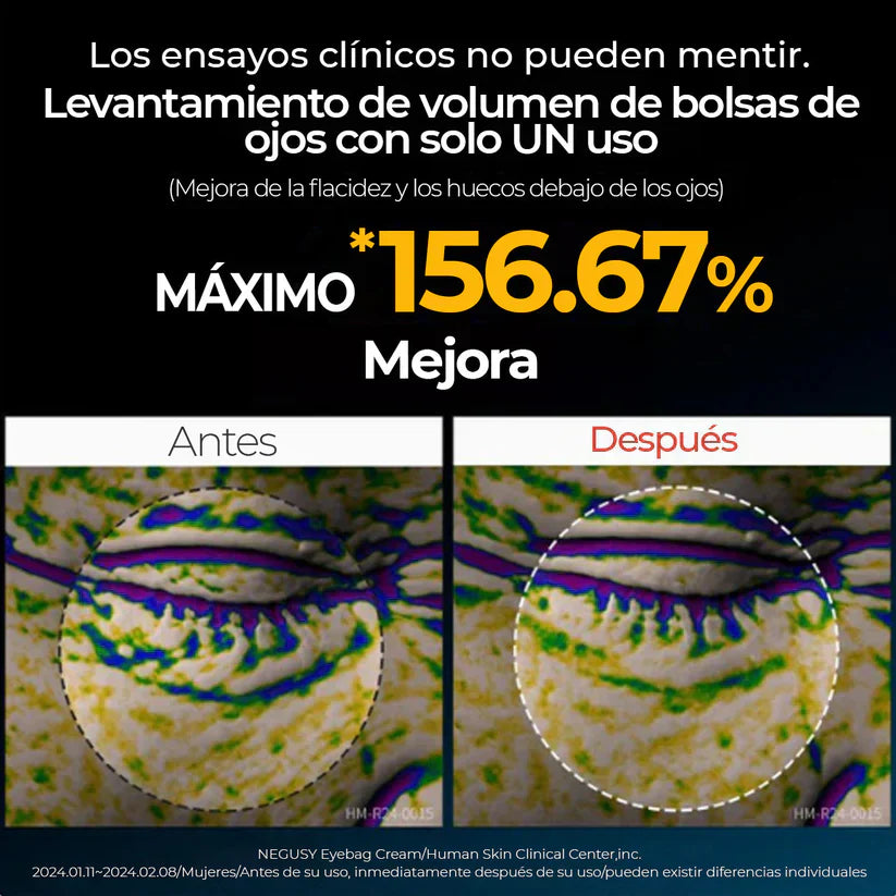 EYEPHALT - Contorno de Ojos Antiarrugas Iluminador Rejuvenecedor