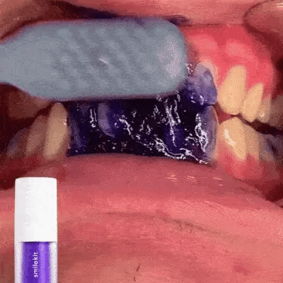 SMILEKIT™ Blanqueador Dental Lila V34 - Paga al Recibir