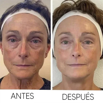 Crema Reafirmante Instantánea – Tensa y Alisa las Arrugas al Momento
