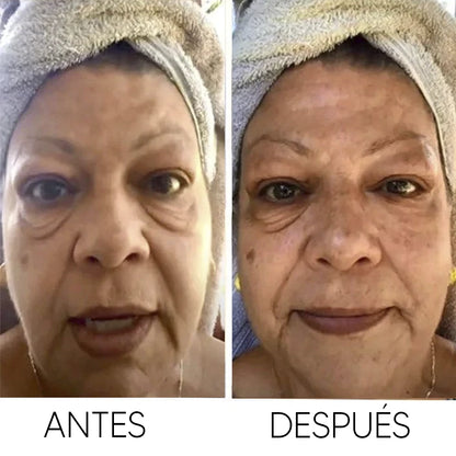 Crema Reafirmante Instantánea – Tensa y Alisa las Arrugas al Momento